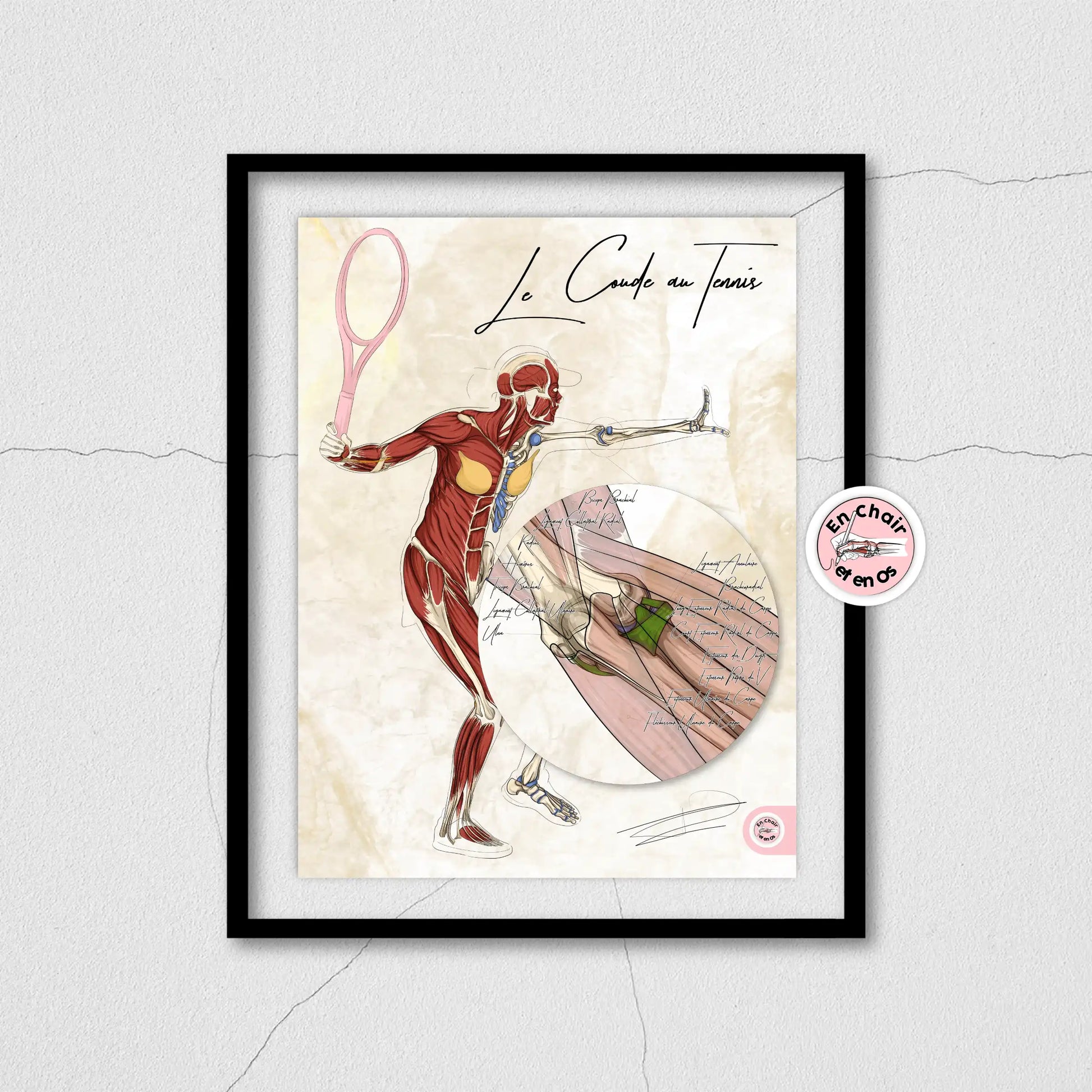 planche anatomique tennis muscles extenseur de l'avant bras 