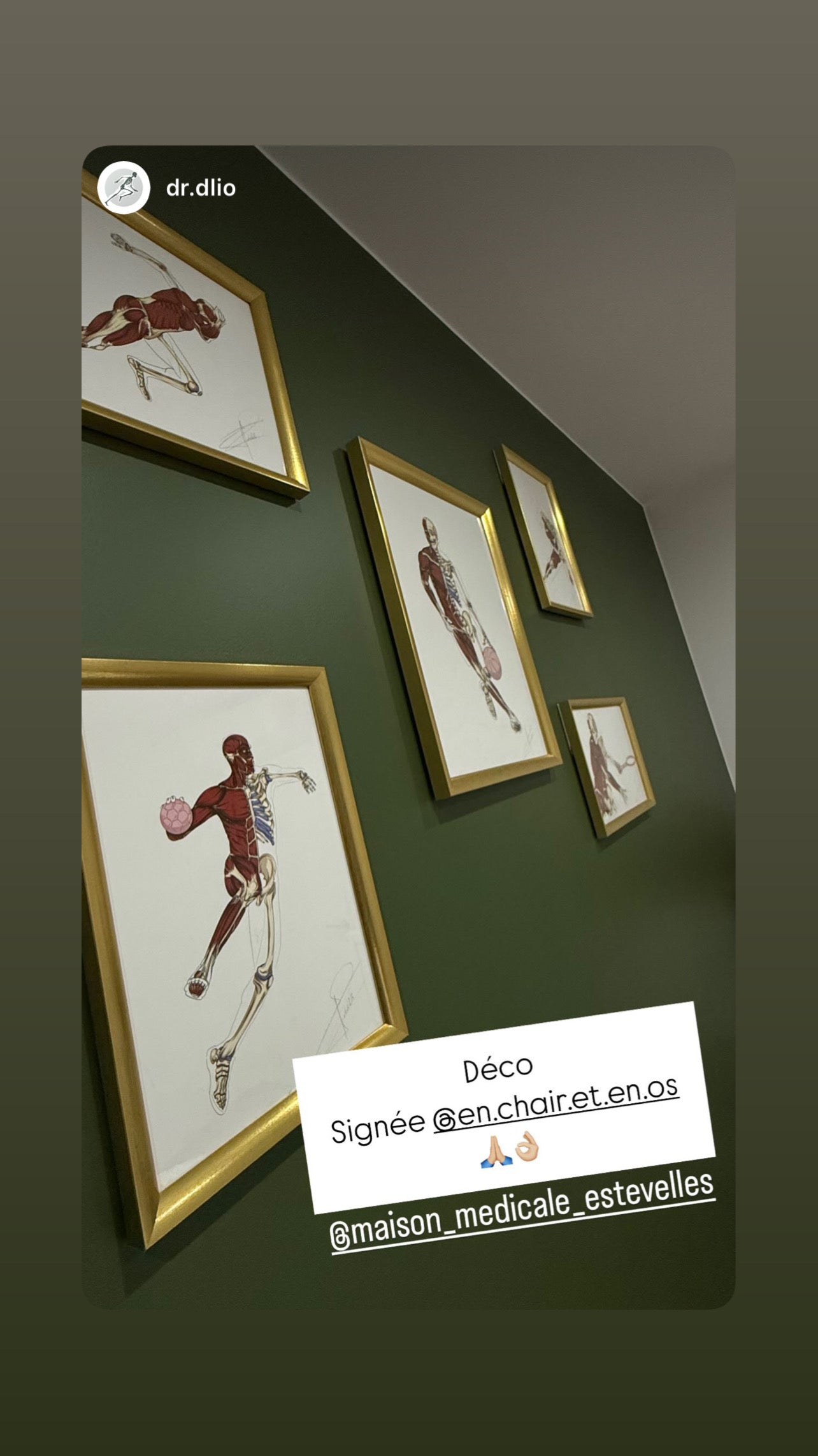 Écorché anatomique du handball